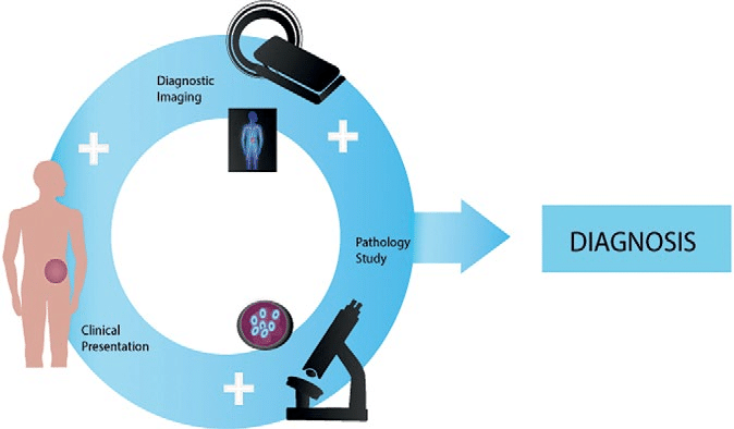 Cancer Diagnosis