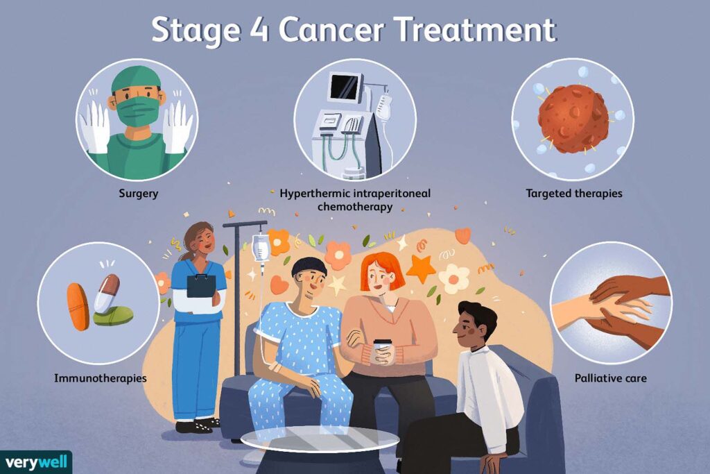 stage 4 cancer treatment