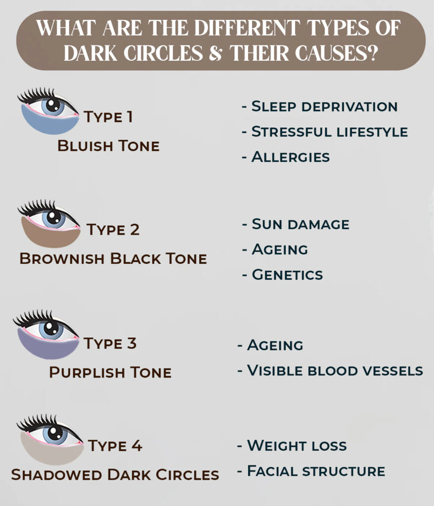 What are the different types of dark circles & their causes