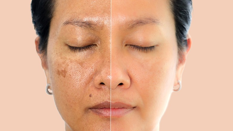 How to Reverse Sun Damage and Restore Your Skin’s Glow