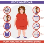 PCOS Symptoms