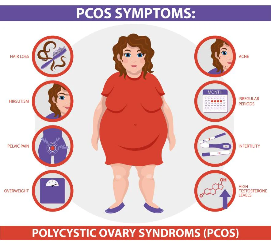 PCOS Symptoms